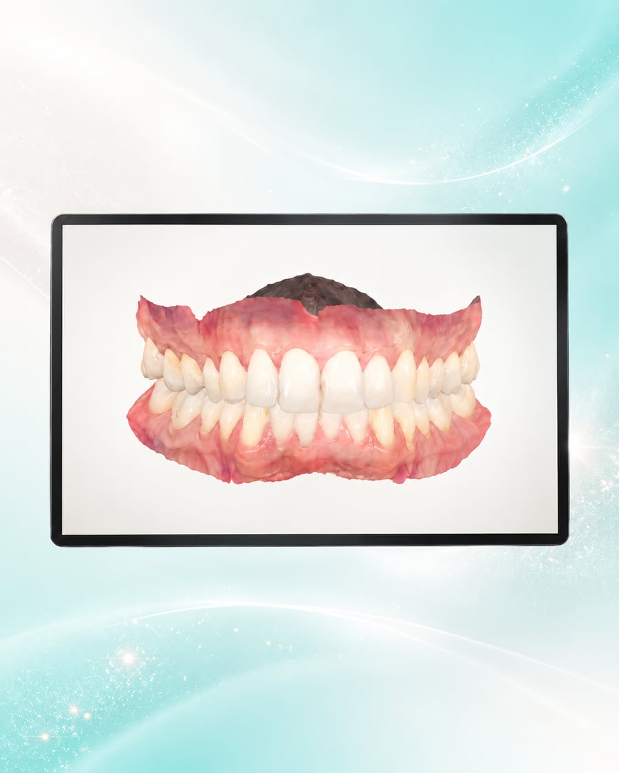 3D image of a patient's teeth and jaw displayed on a monitor at Dr Ray & Partners Dental