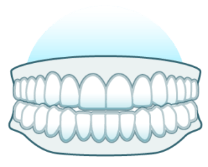 Illustration of teeth wearing clear Angel Aligner trays