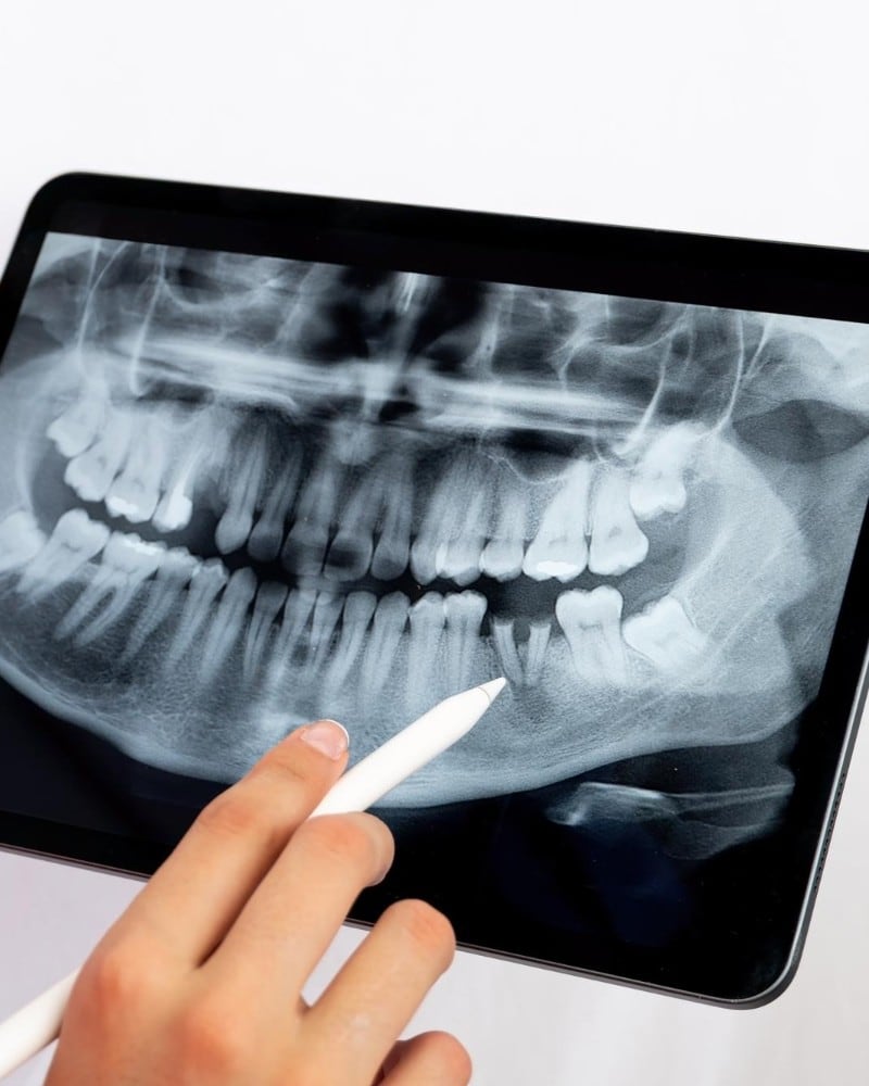 A dentist pointing to a panoramic dental X-ray on a tablet at Dr Ray & Partners Dental