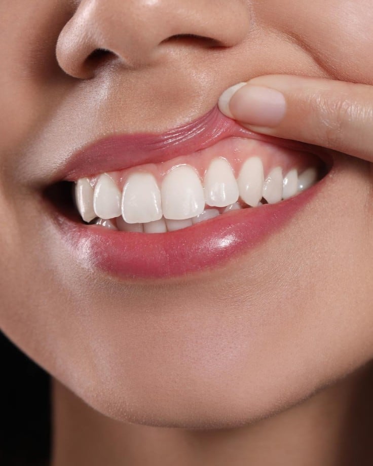 A woman lifting her upper lip to show a healthy, even gum line